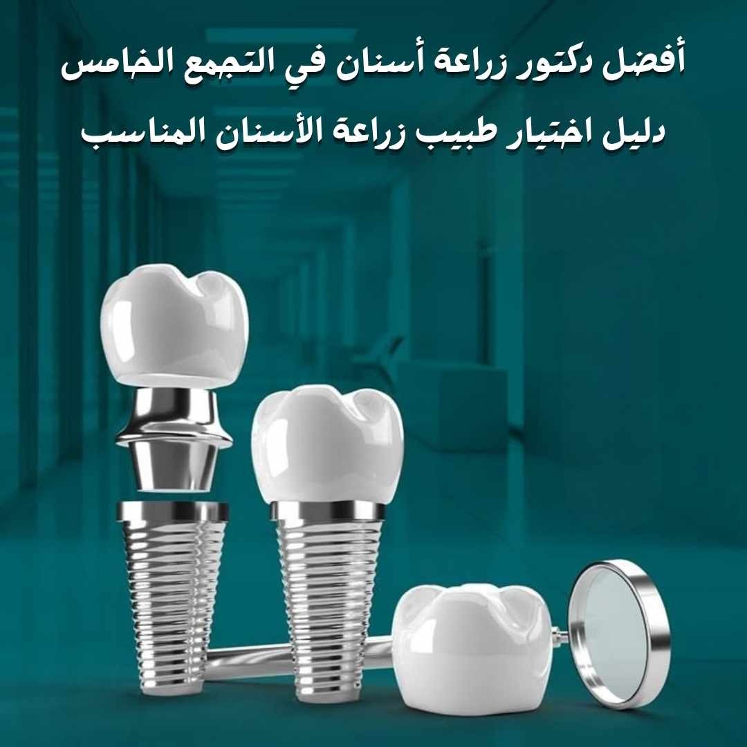 أفضل دكتور زراعة أسنان في التجمع الخامس يقدم حلول زراعة الأسنان وتعويض الأسنان المفقودة باستخدام أحدث التقنيات